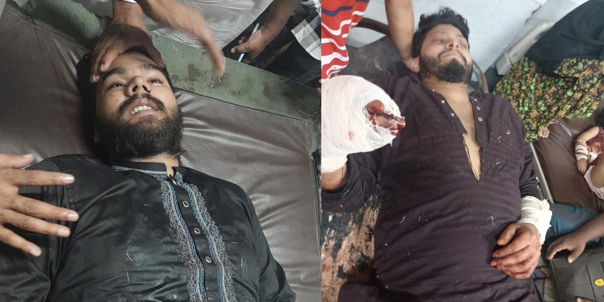 সিলেট ইঞ্জিনিয়ারিং কলেজ ছাত্রলীগ সম্পাদকসহ ২ জনকে হাতের রগ কেটে কুপিয়ে জখম
